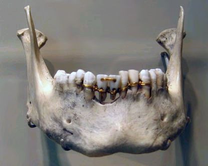 125960623086 - congenitaldisease this image showing dental